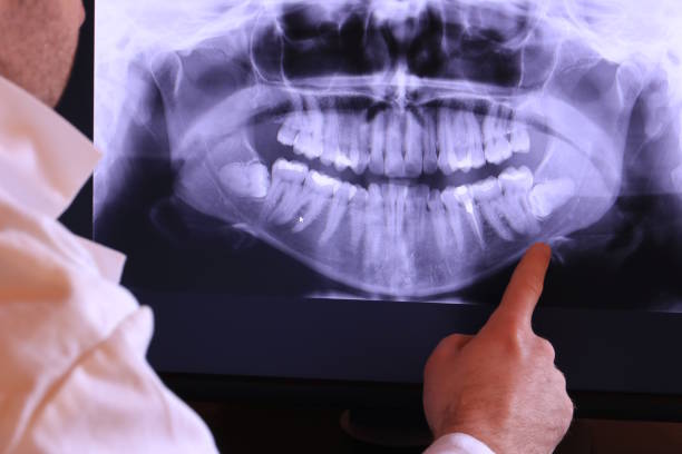 Best Knocked-Out Tooth Emergency  in Bayshore Gardens, FL